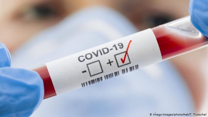 covid-19-pozitif2.jpg